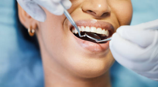 Best Dental Fillings (Composite and Amalgam)  in Fall River, MA